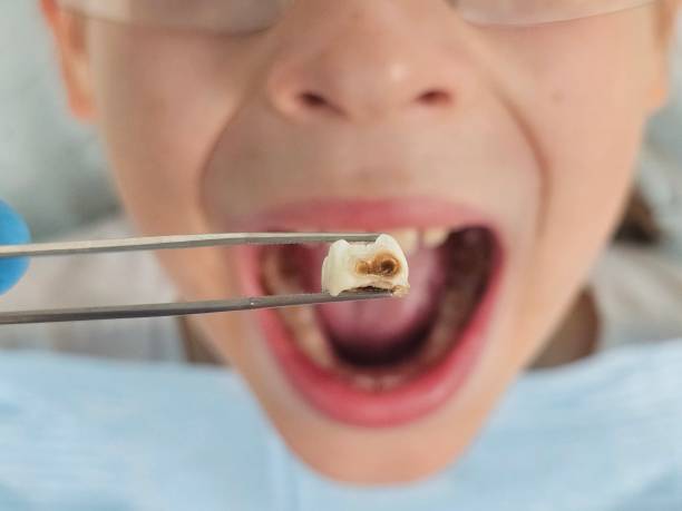 Best Teeth Whitening  in Ironton, OH